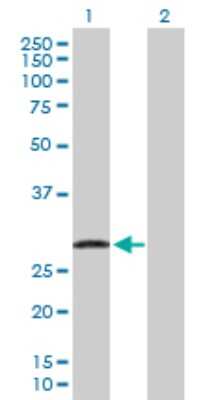 Western Blot: UBE2J2/UBC6 Antibody [H00118424-D01P] - Analysis of UBE2J2 expression in transfected 293T cell line by UBE2J2 polyclonal antibody.Lane 1: UBE2J2 transfected lysate(28.90 KDa).Lane 2: Non-transfected lysate.
