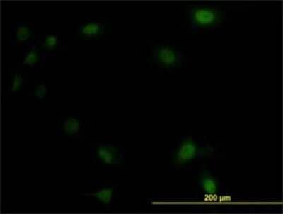 Immunocytochemistry/Immunofluorescence: UBE2M/Ubc12 Antibody (3C4) [H00009040-M01] - Analysis of monoclonal antibody to UBE2M on HeLa cell. Antibody concentration 10 ug/ml.