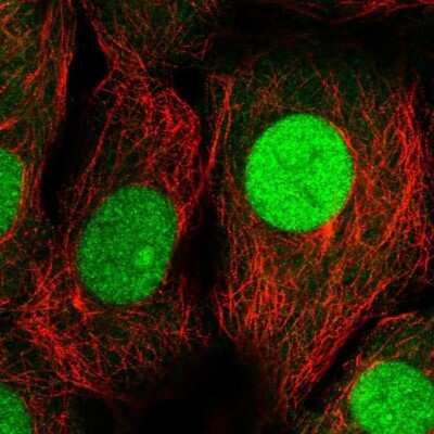 <b>Independent Antibodies Validation. </b>Immunocytochemistry/Immunofluorescence: UBE2M/Ubc12 Antibody [NBP2-49268] - Immunofluorescent staining of human cell line MCF7 shows localization to nucleus & nucleoli.