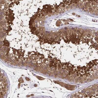 Immunohistochemistry-Paraffin: UBE2M/Ubc12 Antibody [NBP2-49137] - Staining of human testis shows strong cytoplasmic and nuclear positivity in cells in seminiferus ducts.