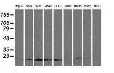 Western Blot: UBE2M/Ubc12 Antibody (OTI2D9) - Azide and BSA Free [NBP2-74748] - Analysis of extracts (35ug) from 9 different cell lines by using anti-UBE2M monoclonal antibody.