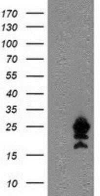 Western Blot: UBE2M/Ubc12 Antibody (OTI2D9) - Azide and BSA Free [NBP2-74748] - HEK293T cells were transfected with the pCMV6-ENTRY control (Left lane) or pCMV6-ENTRY UBE2M (Right lane) cDNA for 48 hrs and lysed. Equivalent amounts of cell lysates (5 ug per lane) were separated by SDS-PAGE and immunoblotted with anti-UBE2M.