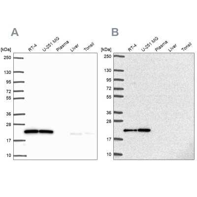 Western Blot: UBE2M/Ubc12 Antibody [NBP2-49268] - Analysis using Anti-UBE2M antibody NBP2-49268 (A) shows similar pattern to independent antibody NBP2-49137 (B).