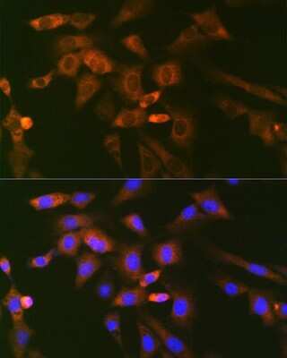 Immunocytochemistry/Immunofluorescence: UBE2N/Ubc13 Antibody (10O9Z5) [NBP3-16793] - Immunofluorescence analysis of NIH-3T3 cells using UBE2N/Ubc13 Rabbit mAb (NBP3-16793) at dilution of 1:100 (40x lens). Blue: DAPI for nuclear staining.