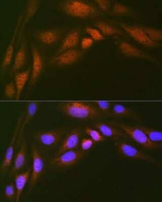 Immunocytochemistry/Immunofluorescence: UBE2N/Ubc13 Antibody (10O9Z5) [NBP3-16793] - Immunofluorescence analysis of U-2 OS cells using UBE2N/Ubc13 Rabbit mAb (NBP3-16793) at dilution of 1:100 (40x lens). Blue: DAPI for nuclear staining.