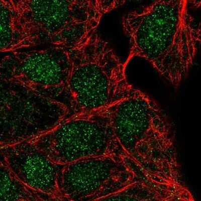 Immunocytochemistry/Immunofluorescence: UBE2N/Ubc13 Antibody [NBP2-48823] - Immunofluorescent staining of human cell line RT4 shows localization to nucleus.