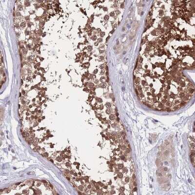 Immunohistochemistry-Paraffin: UBE2N/Ubc13 Antibody [NBP2-48823] - Staining of human testis shows high expression.