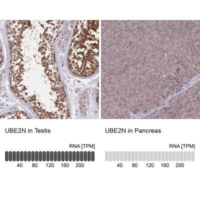 Immunohistochemistry-Paraffin: UBE2N/Ubc13 Antibody [NBP2-48823] - Staining in human testis and pancreas tissues using anti-UBE2N antibody. Corresponding UBE2N RNA-seq data are presented for the same tissues.