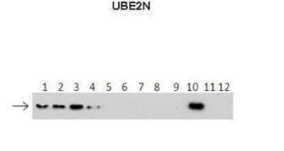 Western Blot: UBE2N/Ubc13 Antibody [NBP1-55027] - Lanes: 1 : 40 ng HIS-UBE2D1 protein2: 40 ng HIS-UBE2D2 protein3: 40 ng HIS-UBE2D3 protein4: 40 ng HIS-UBE2D4 protein5: 40 ng HIS-UBE2E1 protein6: 40 ng HIS-UBE2E2 protein7: 40 ng HIS-UBE2E3 protein8: 40 ng HIS-UBE2K protein9: 40 ng HIS-UBE2L3 protein10: 40 ng HIS-UBE2N protein11 : 40 ng HIS-UBE2V1 protein12: 40 ng HIS-UBE2V2 protein. Primary Antibody Dilution: 1 : 500 Secondary Antibody: Anti-rabbit-HRP Secondary Antibody Dilution: 1 : 50,000 Gene name: UBE2N Submitted by: Dr Chris Boutell. MRC-UoG Centre for Virus Research (CVR), UK.