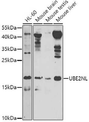 Western Blot: UBE2NL Antibody [NBP3-05571] - Western blot analysis of extracts of various cell lines, using UBE2NL antibody (NBP3-05571) at 1:1000 dilution. Secondary antibody: HRP Goat Anti-Rabbit IgG (H+L) at 1:10000 dilution. Lysates/proteins: 25ug per lane. Blocking buffer: 3% nonfat dry milk in TBST. Detection: ECL Basic Kit. Exposure time: 60s.