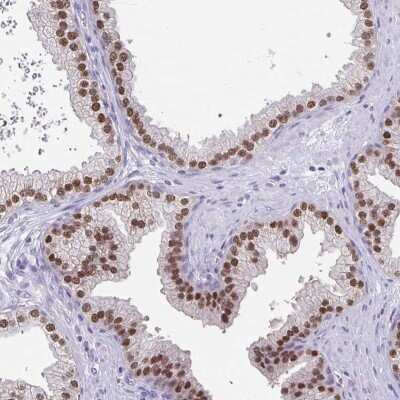 Immunohistochemistry-Paraffin UBE2Q1 Antibody - BSA Free
