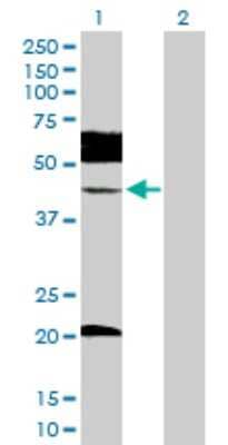 Western Blot: UBE2Q2 Antibody [H00092912-D01P] - Analysis of UBE2Q2 expression in transfected 293T cell line by UBE2Q2 polyclonal antibody.Lane 1: UBE2Q2 transfected lysate(42.80 KDa).Lane 2: Non-transfected lysate.