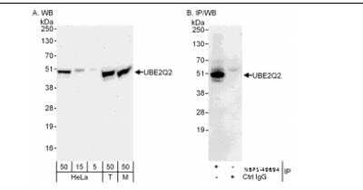 Western Blot UBE2Q2 Antibody
