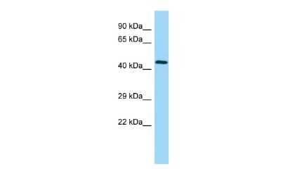Western Blot: UBE2Q2 Antibody [NBP2-82369] - WB Suggested Anti-UBE2Q2 Antibody. Titration: 1.0 ug/ml. Positive Control: Fetal Heart