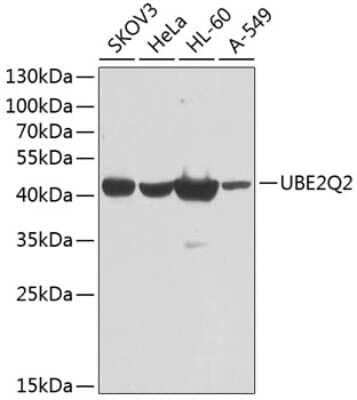 Western Blot: UBE2Q2 Antibody [NBP2-94350] - Analysis of extracts of various cell lines, using UBE2Q2 at 1:1000 dilution. Secondary antibody: HRP Goat Anti-Rabbit IgG (H+L) at 1:10000 dilution. Lysates/proteins: 25ug per lane. Blocking buffer: 3% nonfat dry milk in TBST. Detection: ECL Basic Kit . Exposure time: 60s.