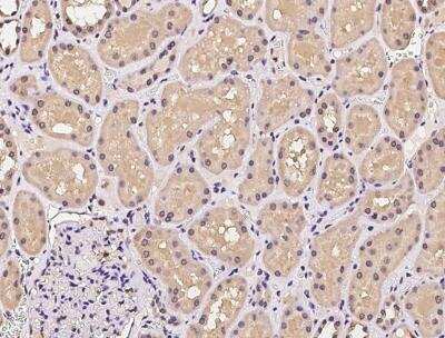 Immunohistochemistry-Paraffin: UBE2R1/CDC34 Antibody [NBP3-06560] - Staining of human CDC34 in human kidney with rabbit polyclonal antibody at 1:100 dilution.
