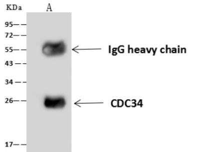 Immunoprecipitation: UBE2R1/CDC34 Antibody [NBP3-06560] - Lane A:0.5 mg K562 Whole Cell Lysate4 uL anti-CDC34 rabbit polyclonal antibody and 60 ug of Immunomagnetic beads Protein A/G.Primary antibody:Anti-CDC34 rabbit polyclonal antibody,at 1:100 dilution Secondary antibody:Goat Anti-Rabbit IgG (H+L)/HRP at 1/10000 dilutionDeveloped using the ECL technique.Performed under reducing conditions.Predicted band size: 26 kDaObserved band size :26 kDa