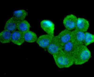 Immunocytochemistry/Immunofluorescence: UBE2R1/CDC34 Antibody (JJ086-07) [NBP2-67835] - Staining Cdc34 in N2A cells (green). The nuclear counter stain is DAPI (blue). Cells were fixed in paraformaldehyde, permeabilised with 0.25% Triton X100/PBS.