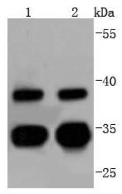 Western Blot: UBE2R1/CDC34 Antibody (JJ086-07) [NBP2-67835] - Analysis of Cdc34 on different lysates using anti-Cdc34 antibody at 1/1,000 dilution. Positive control: Lane 1: K562 Lane 2: Jurkat