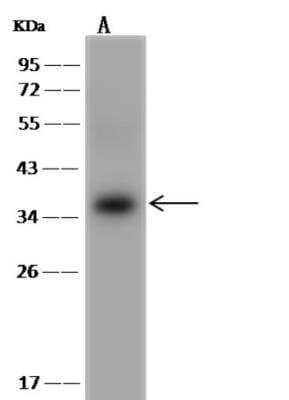 Western Blot: UBE2R1/CDC34 Antibody [NBP3-06560] - Lane A: K562 Whole Cell LysateLysates/proteins at 30 ug per lane.SecondaryGoat Anti-Rabbit IgG (H+L)/HRP at 1/10000 dilution.Developed using the ECL technique.Performed under reducing conditions.Predicted band size:26 kDa