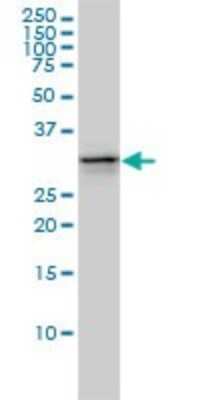 Western Blot UBE2R2 Antibody (5E7) - Azide and BSA Free