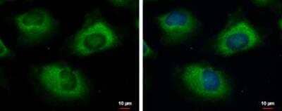 Immunocytochemistry/Immunofluorescence: UBE2R2 Antibody [NBP2-15154] - UBE2R2 antibody detects UBE2R2 protein at cytoplasm by immunofluorescent analysis. Sample: HeLa cells were fixed in 4% paraformaldehyde at RT for 15 min. Green: UBE2R2 protein stained by UBE2R2 antibody diluted at 1:500. Blue: Hoechst 33342 staining. Scale bar = 10 um.