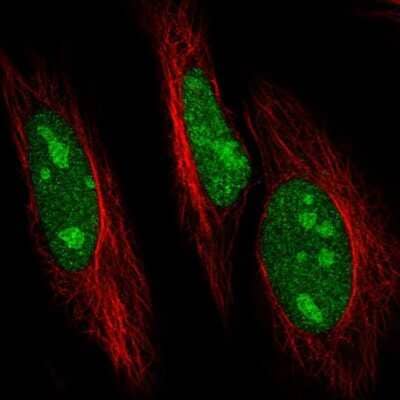 Immunocytochemistry/Immunofluorescence: UBE2R2 Antibody [NBP2-57527] - Staining of human cell line HeLa shows localization to nucleus & nucleoli.