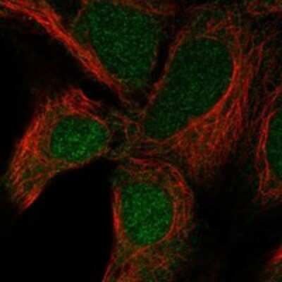 Immunocytochemistry/Immunofluorescence: UBE2R2 Antibody [NBP3-17955] - Staining of human cell line HEK 293 shows localization to nucleoplasm & cytosol.