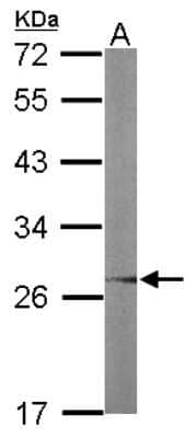 Western Blot: UBE2R2 Antibody [NBP2-15154] - Sample (50 ug of whole cell lysate) A: mouse liver 12% SDS PAGE; antibody diluted at 1:1000.