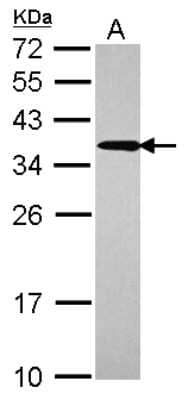 Western Blot UBE2R2 Antibody