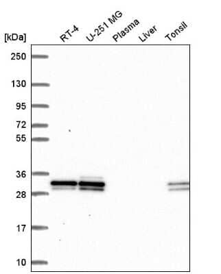 Western Blot: UBE2R2 Antibody [NBP2-57527] - Western blot analysis in human cell line RT-4, human cell line U-251 MG, human plasma, human liver tissue and human tonsil tissue.