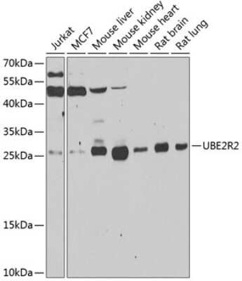 Western Blot UBE2R2 Antibody - BSA Free