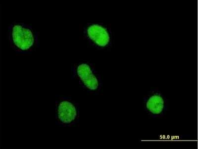 Immunocytochemistry/Immunofluorescence: UBE2S Antibody [H00027338-B01P] - Analysis of purified antibody to UBE2S on HeLa cell. (antibody concentration 10 ug/ml)