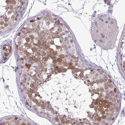 Immunohistochemistry-Paraffin: UBE2S Antibody [NBP2-38822] - Staining of human testis shows moderate nuclear and cytoplasmic positivity in cells in seminiferous ducts.