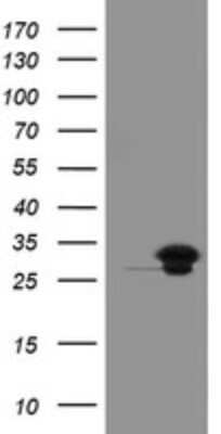 Western Blot: UBE2S Antibody (OTI1B5) - Azide and BSA Free [NBP2-74749] - Analysis of HEK293T cells were transfected with the pCMV6-ENTRY control (Left lane) or pCMV6-ENTRY UBE2S.