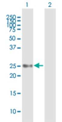 Western Blot: UBE2S Antibody [H00027338-B01P] - Analysis of UBE2S expression in transfected 293T cell line by UBE2S polyclonal antibody.  Lane 1: UBE2S transfected lysate(24.42 KDa). Lane 2: Non-transfected lysate.