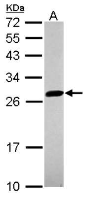 <b>Genetic Strategies Validation. </b>Western Blot: UBE2S Antibody [NBP2-20788] - Sample (30 ug of whole cell lysate) A: HCT116 12% SDS PAGE gel, diluted at 1:1000.