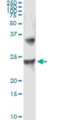 Immunoprecipitation: UBE2T Antibody (1E12-4A3) [H00029089-M01] - Analysis of UBE2T transfected lysate using anti-UBE2T monoclonal antibody and Protein A Magnetic Bead, and immunoblotted with UBE2T MaxPab rabbit polyclonal antibody.