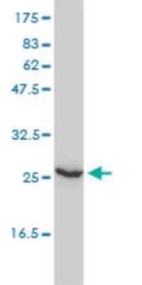 Western Blot: UBE2T Antibody (1E12-4A3) [H00029089-M01] - UBE2T monoclonal antibody (M01), clone 1E12-4A3 Analysis of UBE2T expression in Hela.