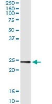 Immunoprecipitation: UBE2T Antibody (2A12-4F11) [H00029089-M03] - Analysis of UBE2T transfected lysate using anti-UBE2T monoclonal antibody and Protein A Magnetic Bead, and immunoblotted with UBE2T rabbit polyclonal antibody.