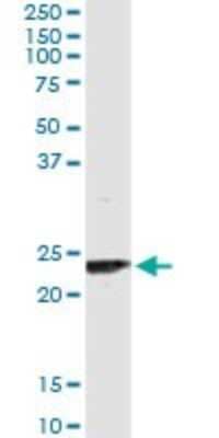 Immunoprecipitation: UBE2T Antibody (4G1-4C2) [H00029089-M02] - Analysis of UBE2T transfected lysate using anti-UBE2T monoclonal antibody and Protein A Magnetic Bead, and immunoblotted with UBE2T MaxPab rabbit polyclonal antibody.