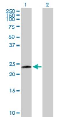 Western Blot: UBE2T Antibody [H00029089-D01P] - Analysis of UBE2T expression in transfected 293T cell line by UBE2T polyclonal antibody.Lane 1: UBE2T transfected lysate(22.50 KDa).Lane 2: Non-transfected lysate.