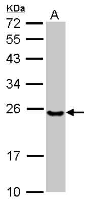 Western Blot: UBE2T Antibody [NBP2-20789] - Sample (30 ug of whole cell lysate) A: NT2D1 12% SDS PAGE gel, diluted at 1:1000.
