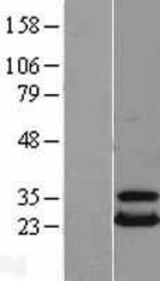 Western Blot UBE2T Overexpression Lysate