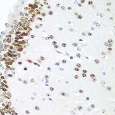 Immunohistochemistry-Paraffin: UBE2U Antibody [NBP2-94609] - Paraffin-embedded mouse brain using UBE2U .