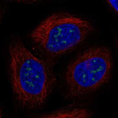 Immunocytochemistry/ Immunofluorescence UBE2W Antibody - BSA Free