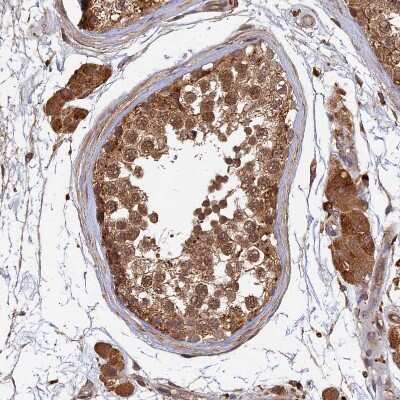 Immunohistochemistry-Paraffin UBE2W Antibody