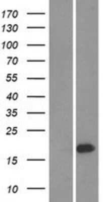 Western Blot UBE2W Overexpression Lysate