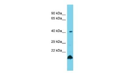 Western Blot: UBE2Z Antibody [NBP2-88535] - Host: Rabbit. Target Name: Ube2z. Sample Type: Rat Testis lysates. Antibody Dilution: 1.0ug/ml