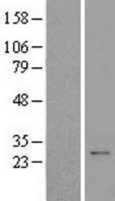 Western Blot UBE2Z Overexpression Lysate